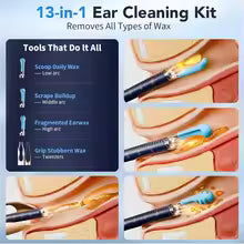 Ear Wax Removal Tool Camera with 1000W Pixels