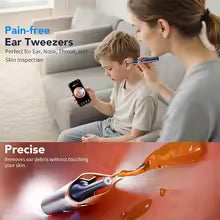Ear Wax Removal Tool Camera with 1000W Pixels