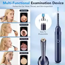 Ear Wax Removal Tool Camera with 1000W Pixels